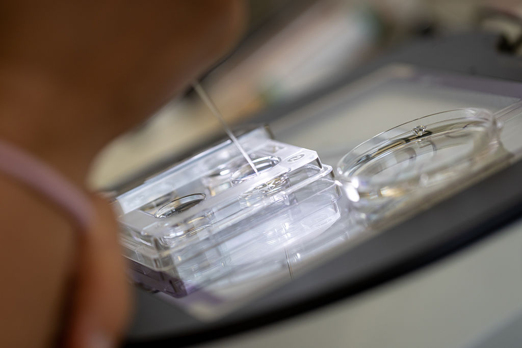 Childhood cancer risk may be higher after some fertility treatments, study finds — FOX 13 Tampa Bay News, Venice Community news